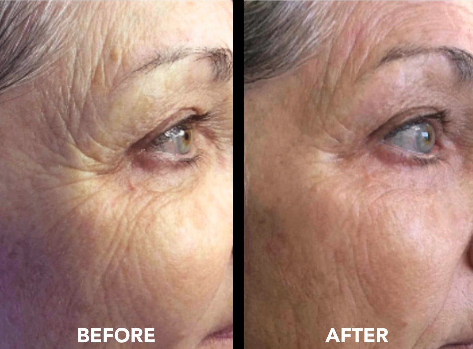 Collaglow™ Firming Peptide Serum